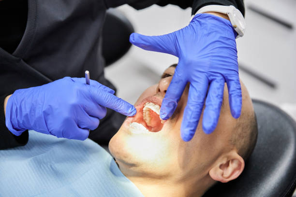 Best Emergency Dental Care for Broken or Chipped Teeth in Lawrenceville, VA