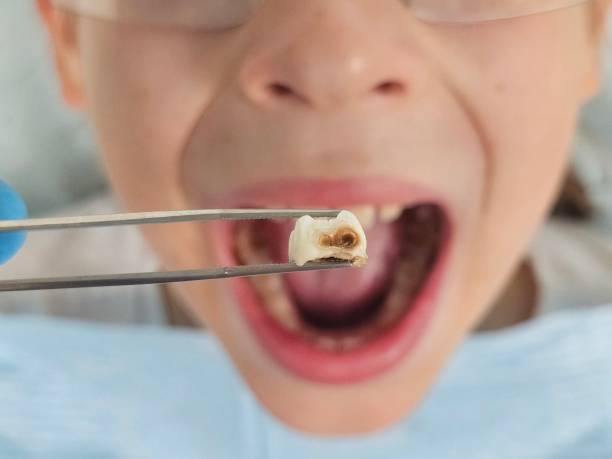 Best Same-Day Emergency Dental Services in Lawrenceville, VA