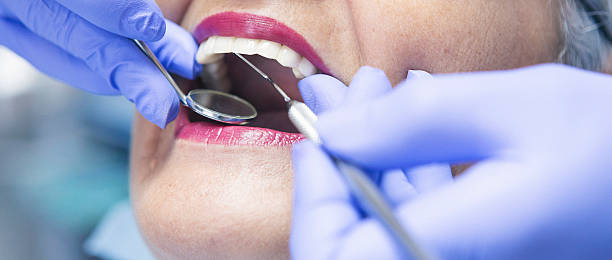 Best Emergency Wisdom Teeth Removal in Lawrenceville, VA