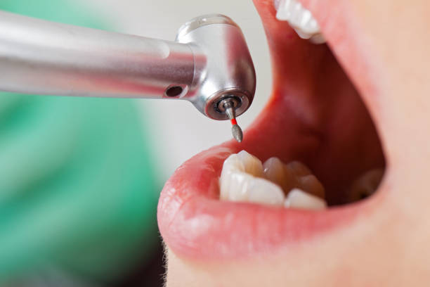 Best Cosmetic Emergency Dentistry in Lawrenceville, VA